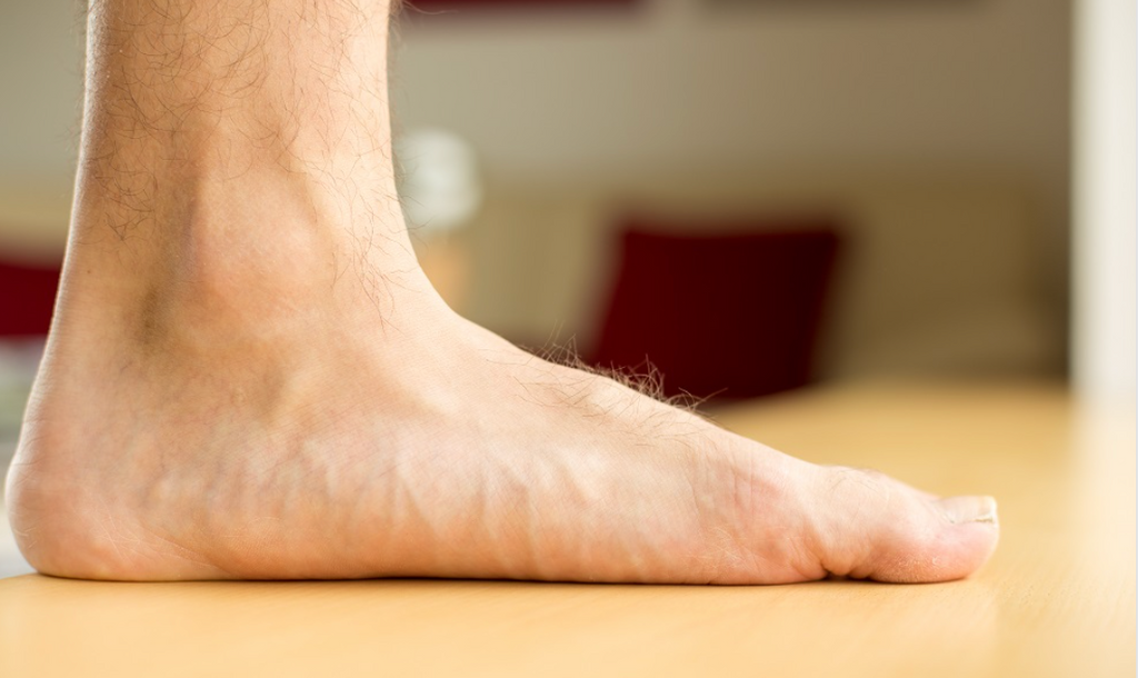 Cures for Flat Feet That Actually Work