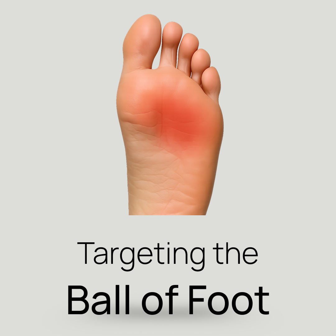 Custom Orthotics for Metatarsalgia