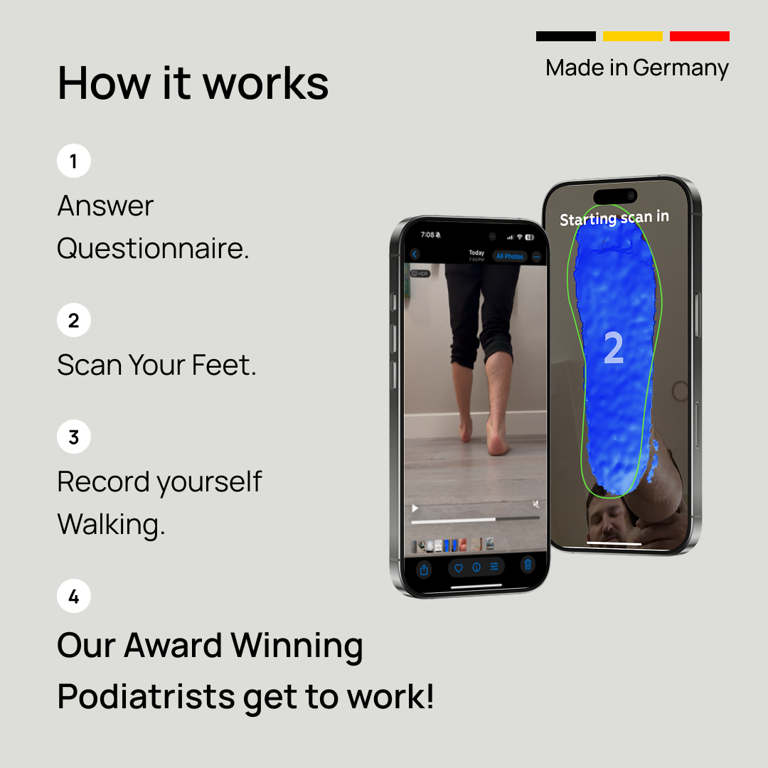 Custom Orthotics for Overpronation