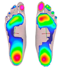 Heel strike balancing. Restored Arch.