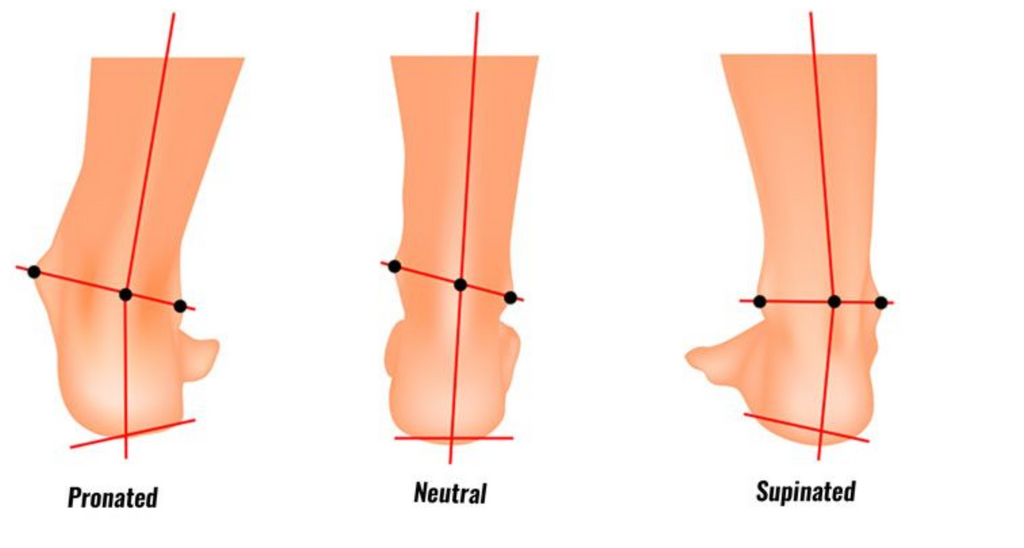 Best Orthotic Inserts for Supination