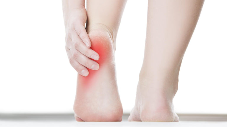 Plantar Fasciitis: The Ultimate Guide to Understanding, Preventing, and Treating Heel Pain