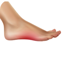 How Effective Are Orthotics?