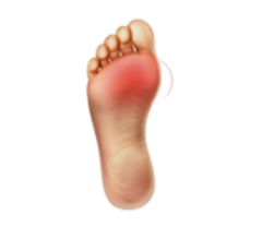 What are Orthotics?