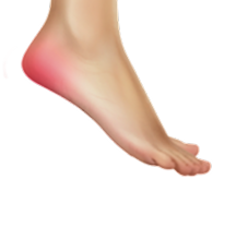 Do orthotics help plantar fasciitis