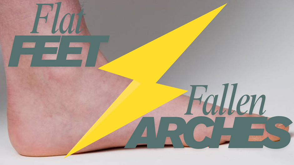 What is the Difference between Flat Feet and Fallen Arches