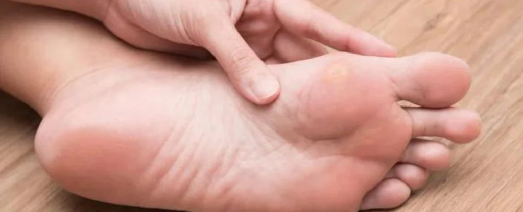 7 Best Orthotics for calluses