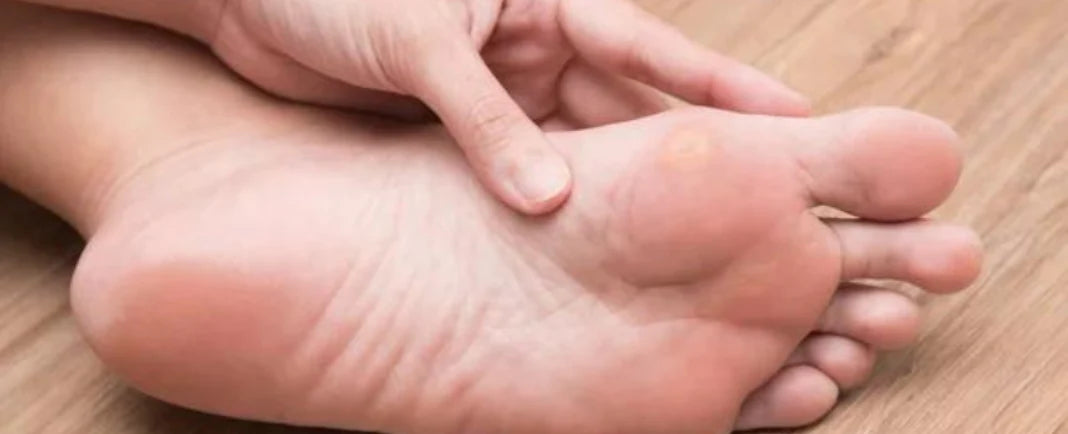 7 Best Orthotics for calluses