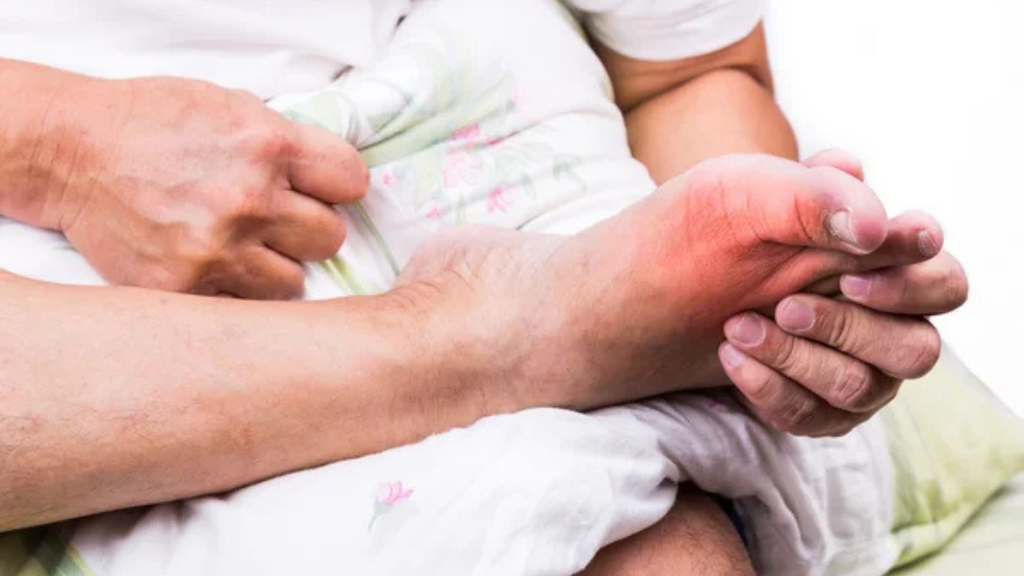 Best Insoles for Gout