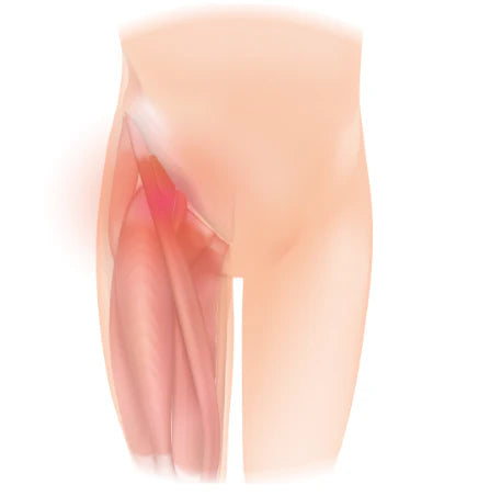 7 Best Insoles for hip pain