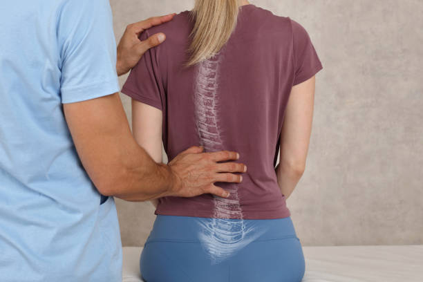 Insoles for Scoliosis