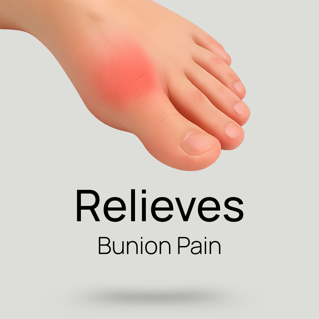 Custom Orthotics for Bunions