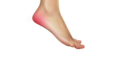 The Heel