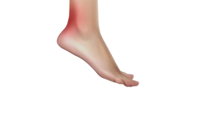 The Achilles Heel