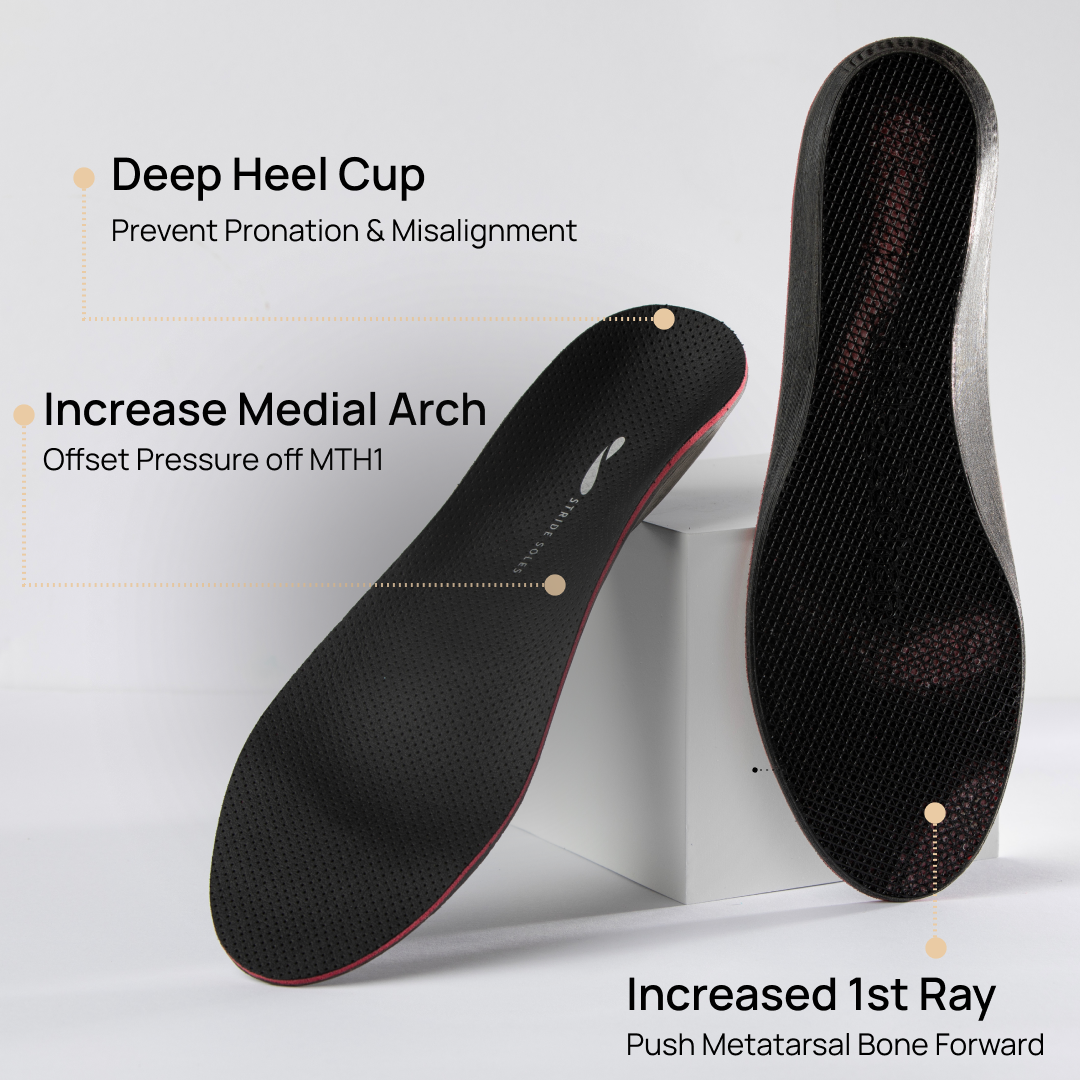 Custom Orthotics for Bunions