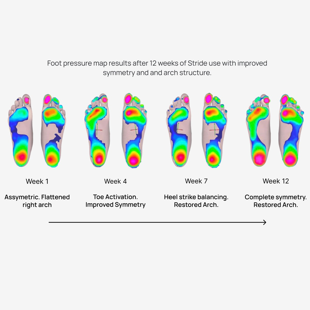 Sensorimotor Orthotics